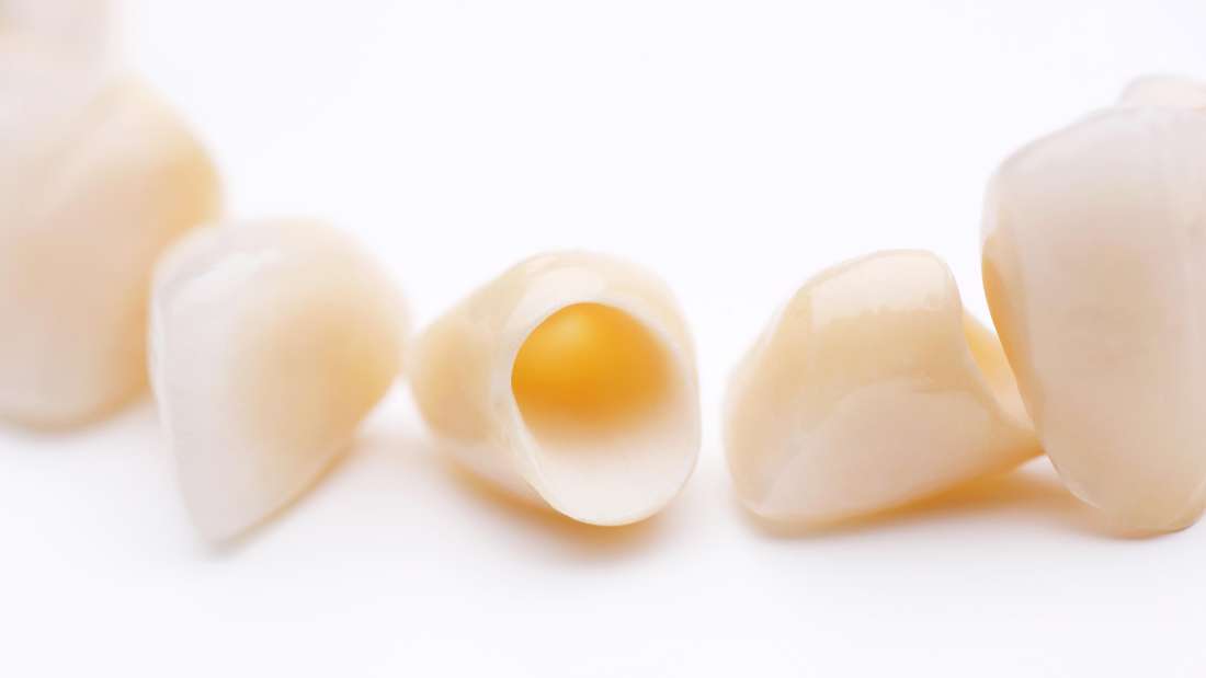 How Long Do Dental Crowns Last? El Dorado Hills Dentist 95762