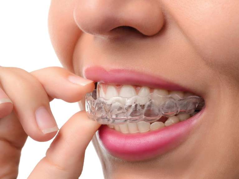 Invisalign Treatment in El Dorado Hills, CA
