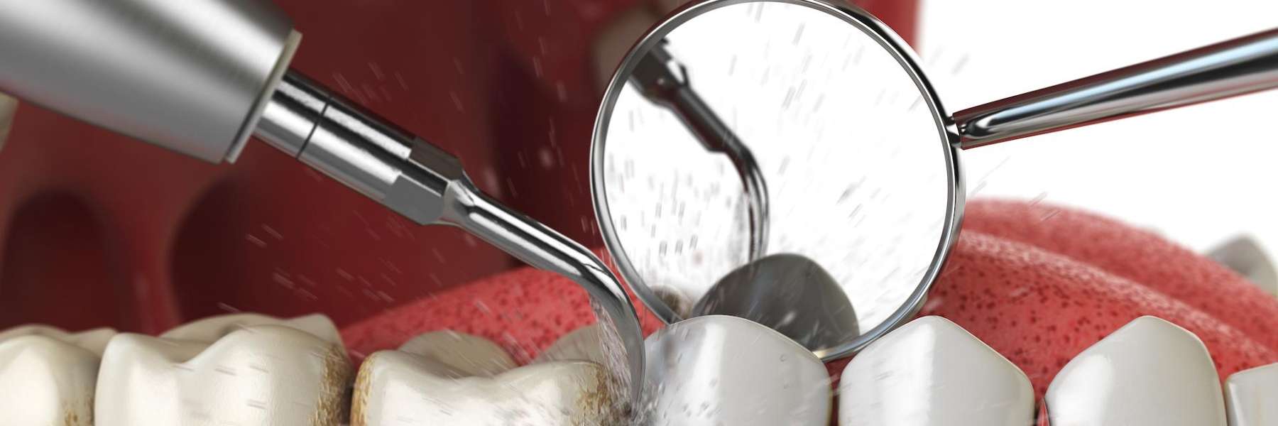 dental cleaning and exams | dentist in el dorado hills ca