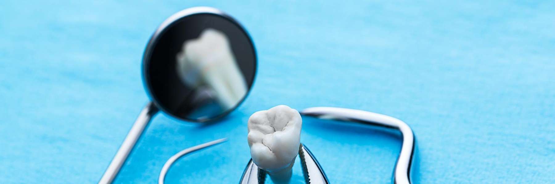 Close-up of teeth after wisdom teeth extraction