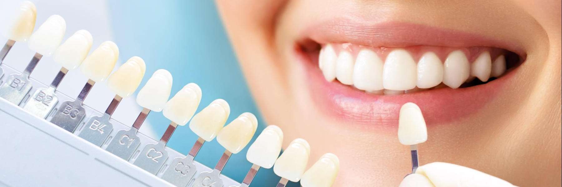 Teeth Whitening | Dentist